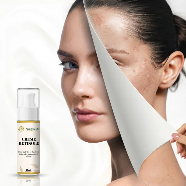 cream retinol zenvyralife